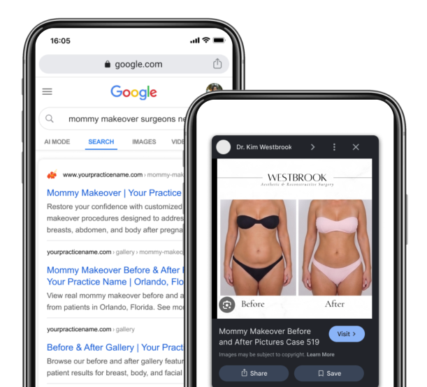 BRAG book SEO and Front-end gallery UI